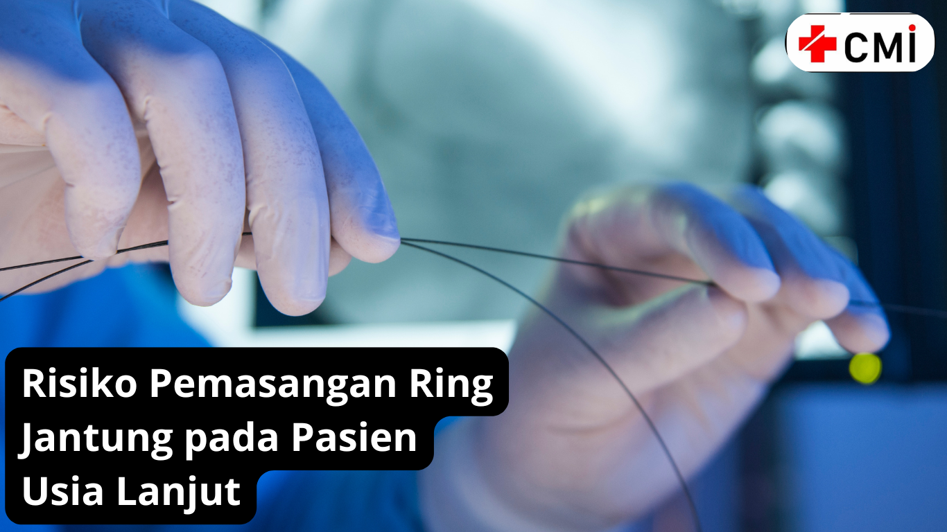 Risiko_Pemasangan_Ring_Jantung_pada_Pasien_Usia_Lanjut.png